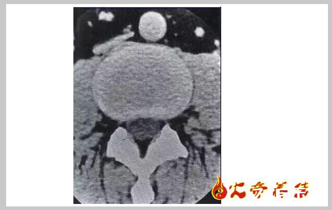 最详细的脊柱腰段解剖图