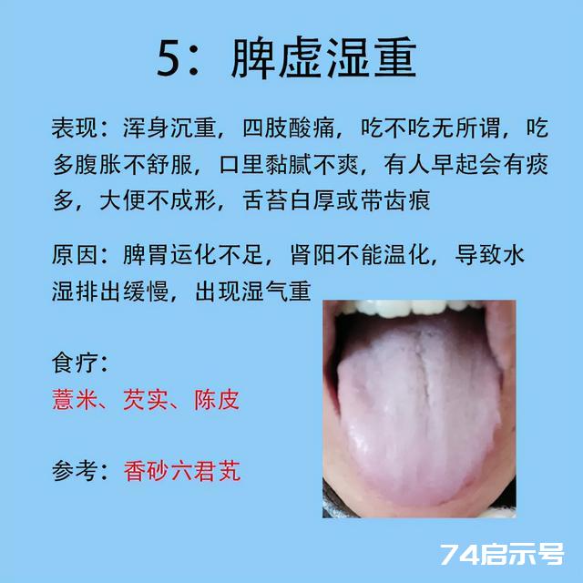 女人常见6种症状，以及对应舌象和解决的方法分享