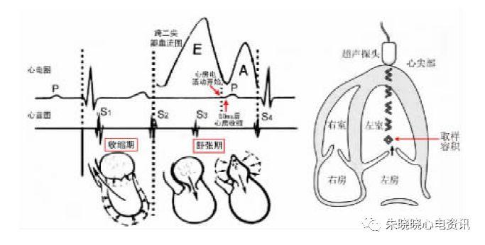 【郭继鸿教授心电系列之三十八】心房颤动性心肌病