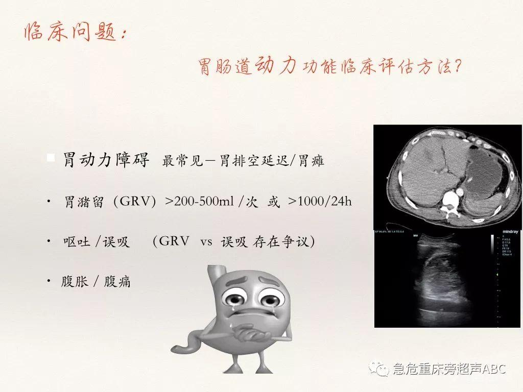 胃肠超声在急危重患者肠内营养中的应用