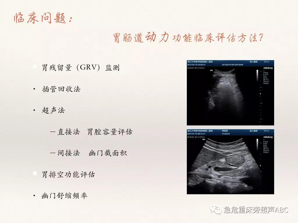 胃肠超声在急危重患者肠内营养中的应用