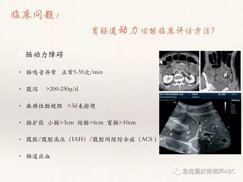 胃肠超声在急危重患者肠内营养中的应用