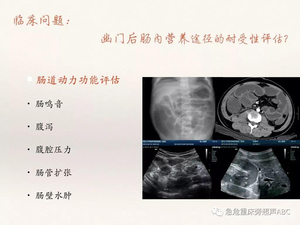 胃肠超声在急危重患者肠内营养中的应用