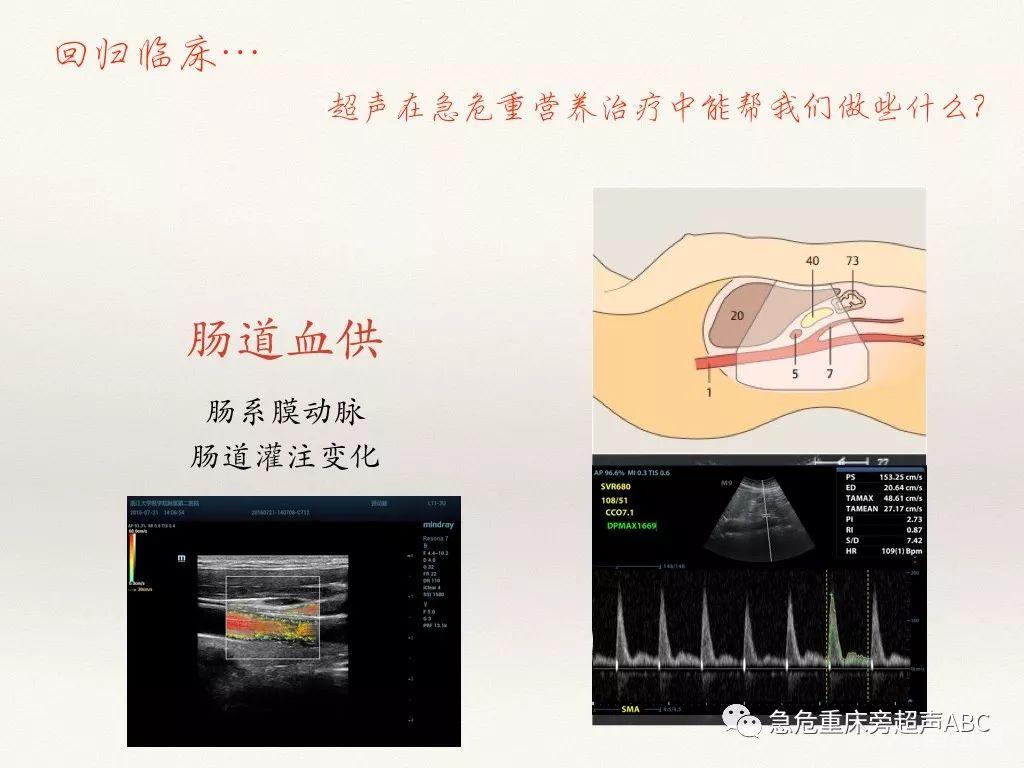 胃肠超声在急危重患者肠内营养中的应用