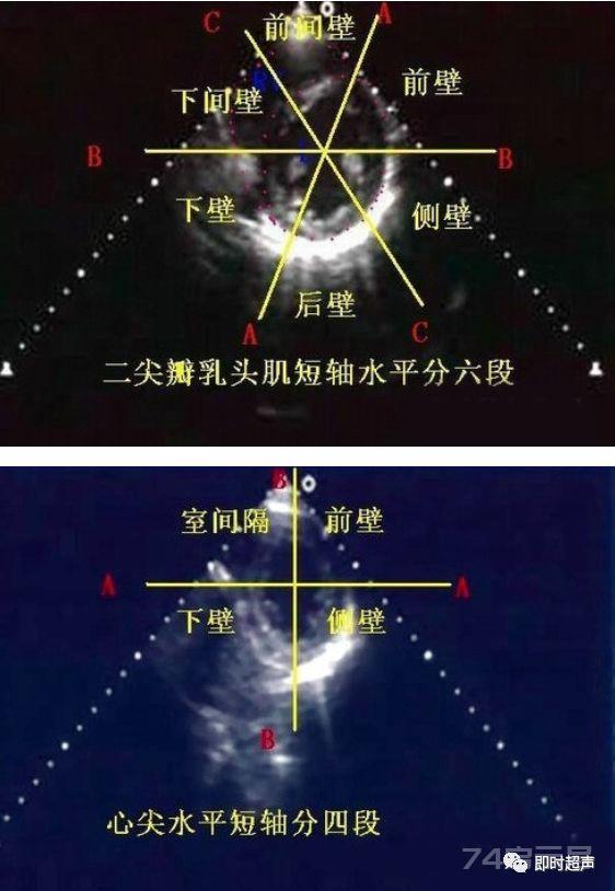 左心室分段的依据、方法与记忆技巧