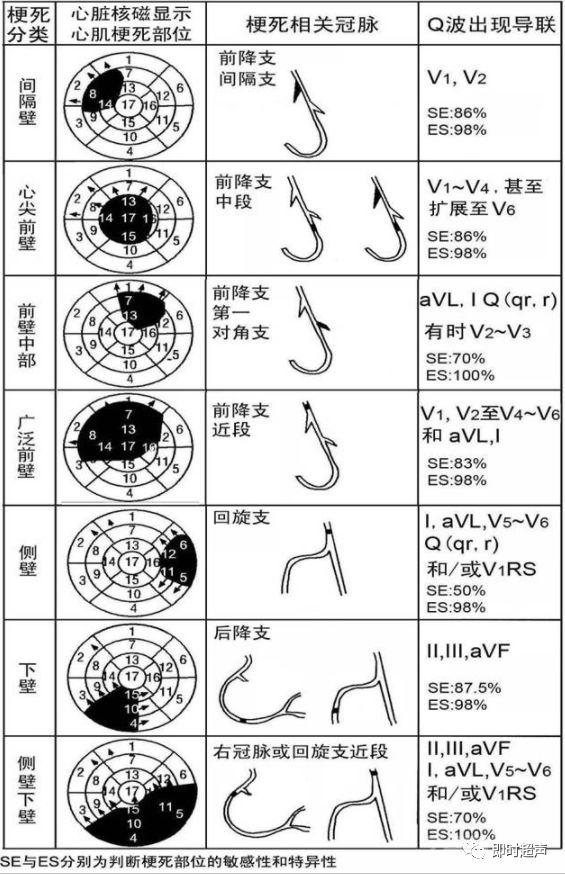 左心室分段的依据、方法与记忆技巧