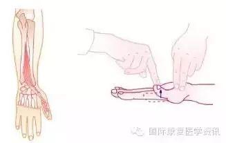 康复评估：运动功能检查——肌力篇