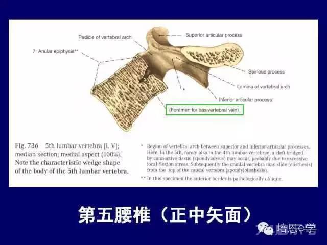 脊柱腰段解剖图（详细标注版 影像图片）