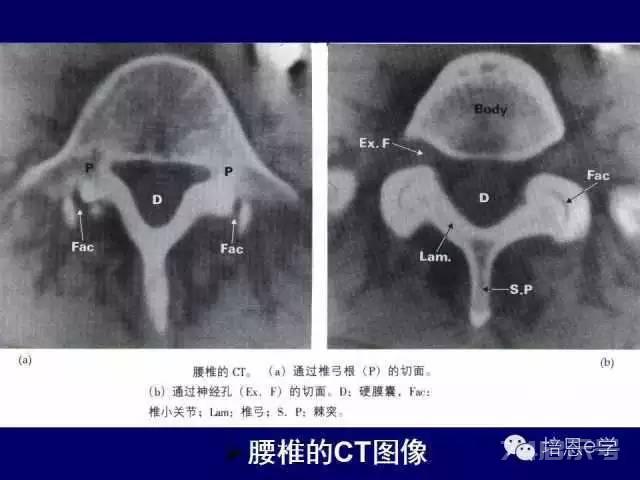 脊柱腰段解剖图（详细标注版 影像图片）