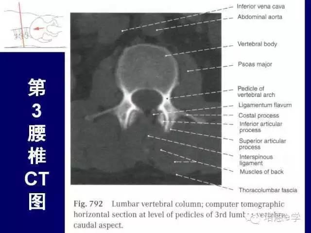 脊柱腰段解剖图（详细标注版 影像图片）