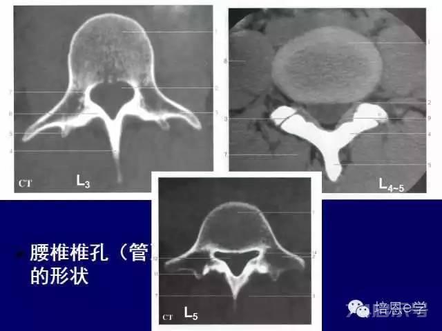 脊柱腰段解剖图（详细标注版 影像图片）