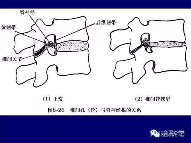 脊柱腰段解剖图（详细标注版 影像图片）