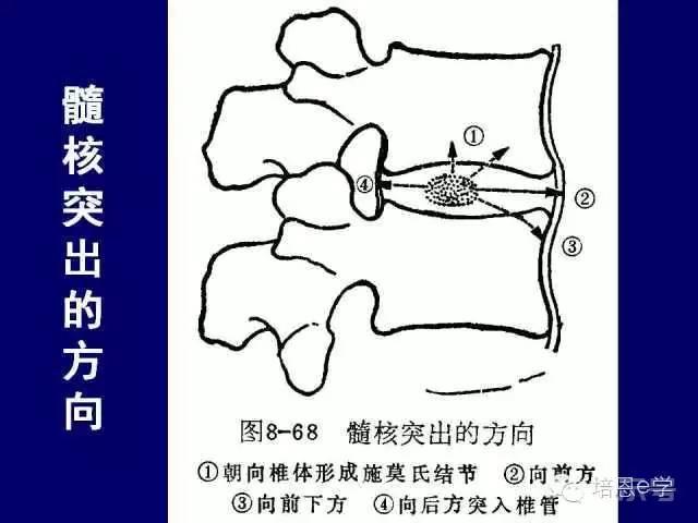 脊柱腰段解剖图（详细标注版 影像图片）