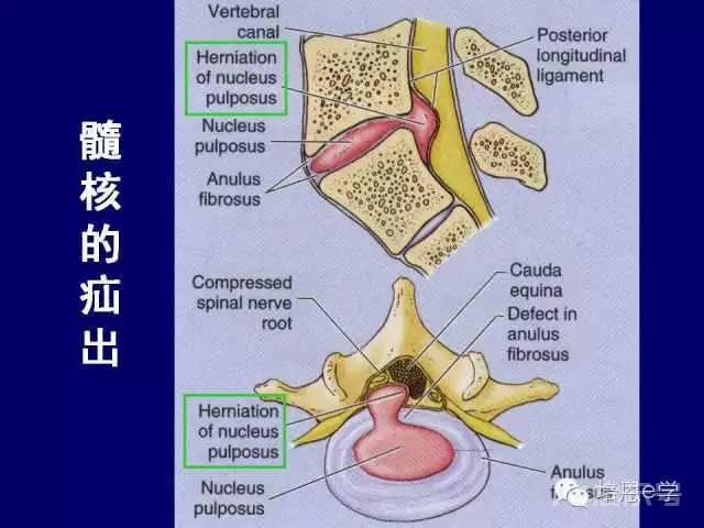 脊柱腰段解剖图（详细标注版 影像图片）