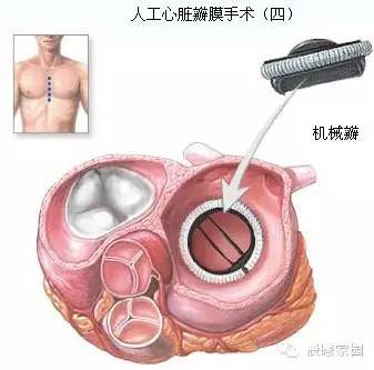 全面解读核磁共振