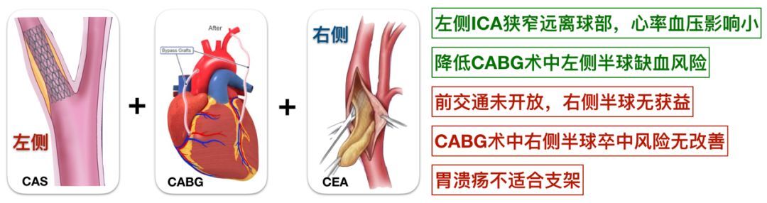 心肌下壁缺血严重吗_如何做到让心肌不缺血_一次性心肌缺血