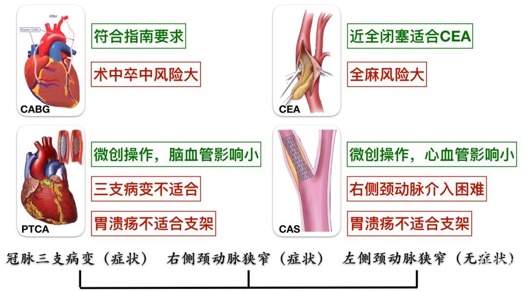 心肌下壁缺血严重吗_如何做到让心肌不缺血_一次性心肌缺血