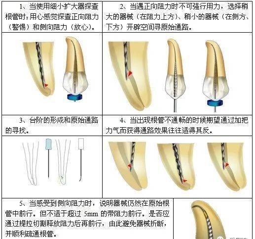 尖有_尖有湿疹是什么病_尖有湿疹会传染吗