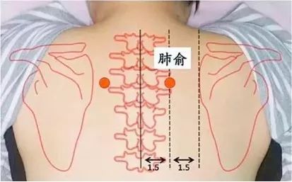 浮针的禁忌症和注意事项