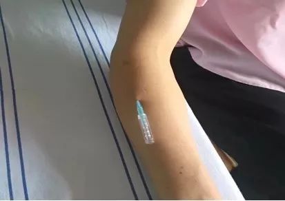 浮针的禁忌症和注意事项