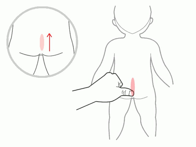 18种小儿推拿手法, 附详细图文, 有孩子的存起来!
