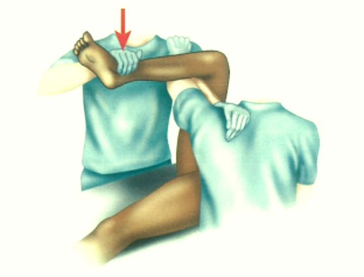 急性髋关节脱位的手法复位，这样「抱大腿」没毛病！