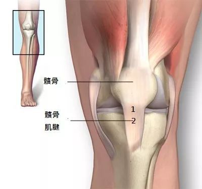 髌骨软化症的影像诊断