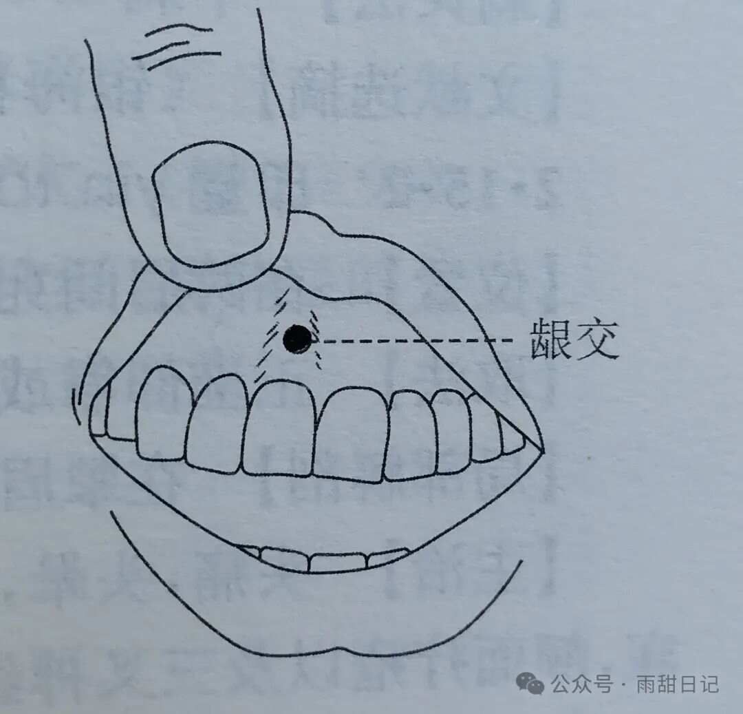 1个让痔疮悄悄“自愈”的方法（不是提肛），你一定要试试