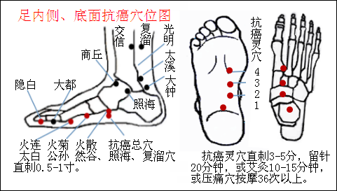 直肠癌治疗“特效穴”