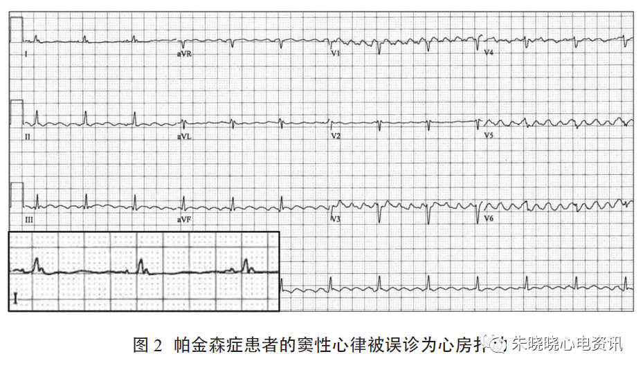 心电质控系列心电检测  质控先行