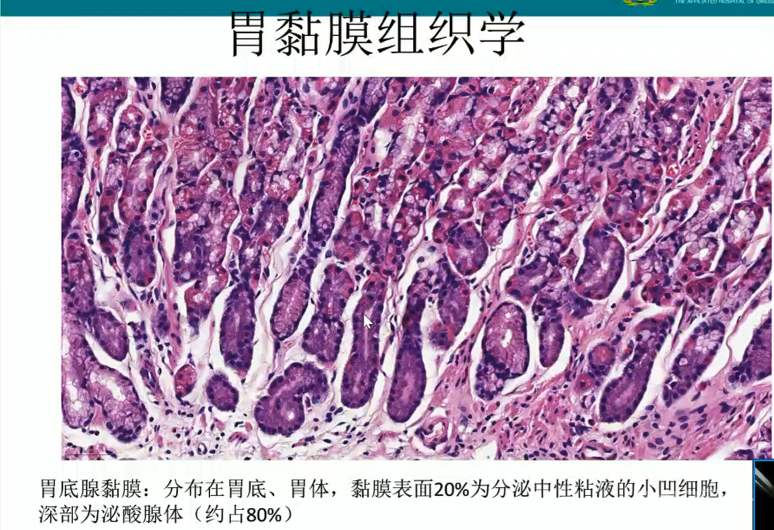 胃活检异型增生病理学习