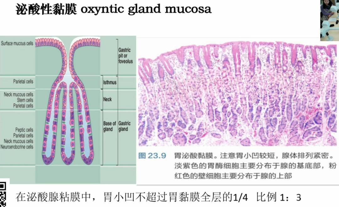 胃活检异型增生病理学习