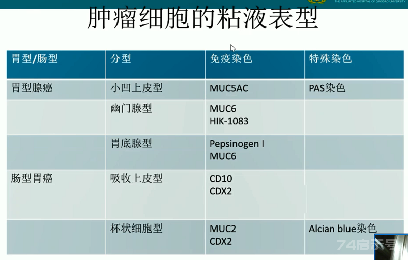 胃活检异型增生病理学习