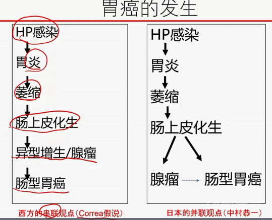 胃活检异型增生病理学习