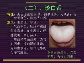 手把手教您-望舌识病情，从中医视角通过舌的颜色来聊疾病