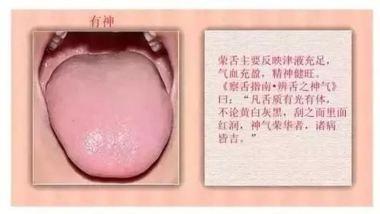 手把手教您-望舌识病情，从中医视角通过舌的颜色来聊疾病