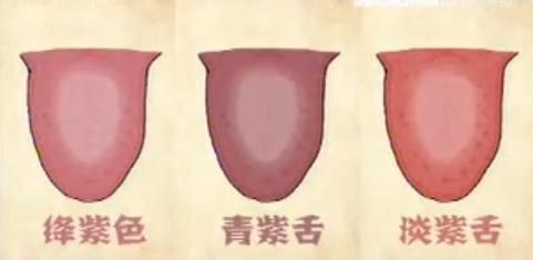 手把手教您-望舌识病情，从中医视角通过舌的颜色来聊疾病