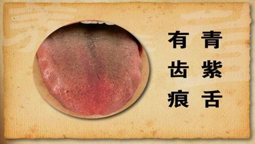 手把手教您-望舌识病情，从中医视角通过舌的颜色来聊疾病