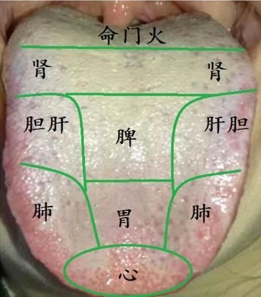 手把手教您-望舌识病情，从中医视角通过舌的颜色来聊疾病