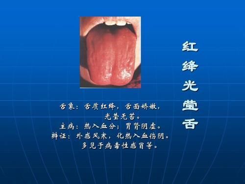 手把手教您-望舌识病情，从中医视角通过舌的颜色来聊疾病