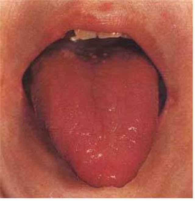 手把手教您-望舌识病情，从中医视角通过舌的颜色来聊疾病